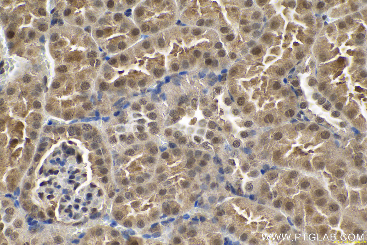 Immunohistochemical analysis of paraffin-embedded mouse kidney tissue slide using KHC0669 (HNRNPU IHC Kit).