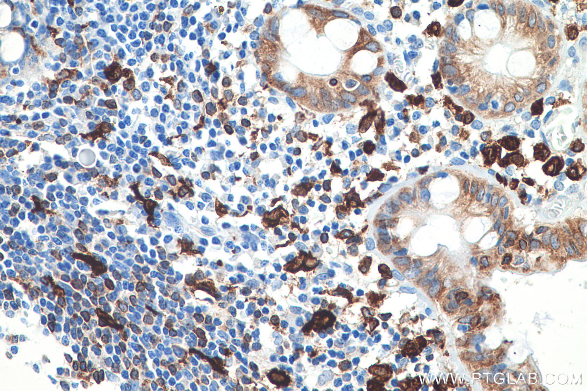 Immunohistochemical analysis of paraffin-embedded human colon tissue slide using KHC0624 (HO-1/HMOX1 IHC Kit).