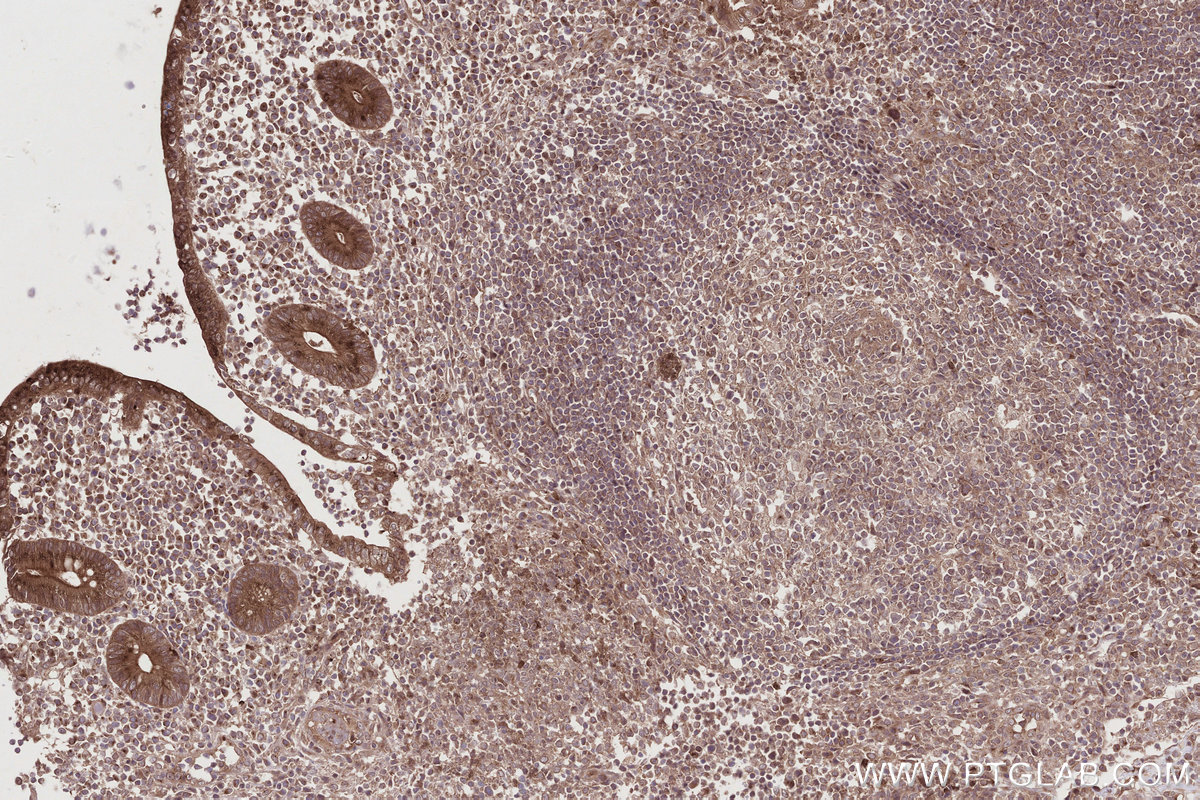 Immunohistochemical analysis of paraffin-embedded human appendicitis tissue slide using KHC2788 (HOOK2 IHC Kit).