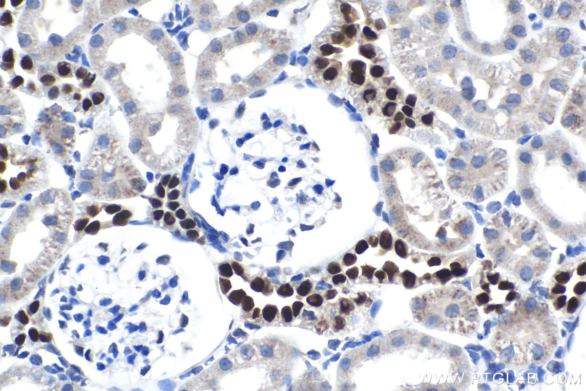 Immunohistochemical analysis of paraffin-embedded rat kidney tissue slide using KHC1529 (HOXD8 IHC Kit).