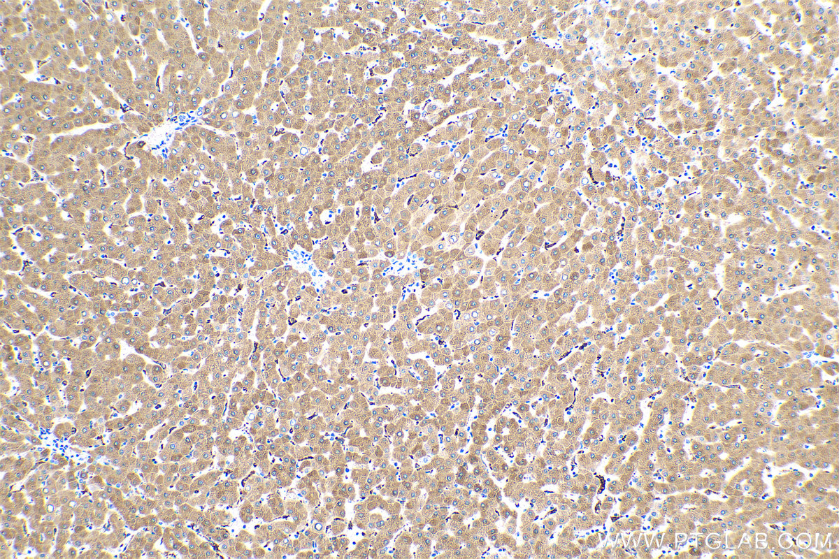 Immunohistochemical analysis of paraffin-embedded human liver tissue slide using KHC0425 (HP IHC Kit).