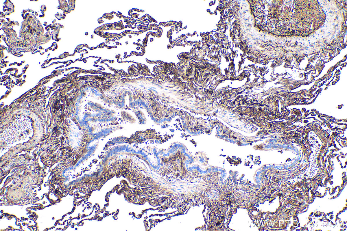 Immunohistochemical analysis of paraffin-embedded human lung tissue slide using KHC0425 (HP IHC Kit).