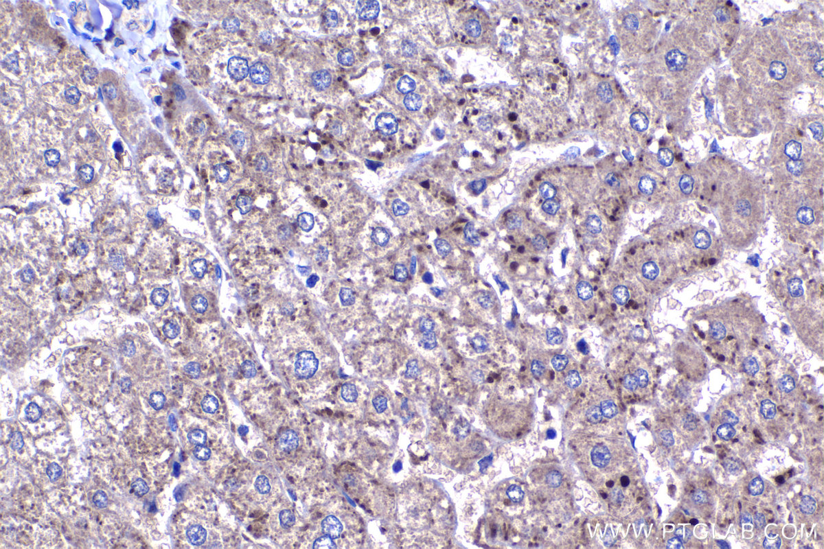 Immunohistochemical analysis of paraffin-embedded human liver tissue slide using KHC1307 (HPDL IHC Kit).