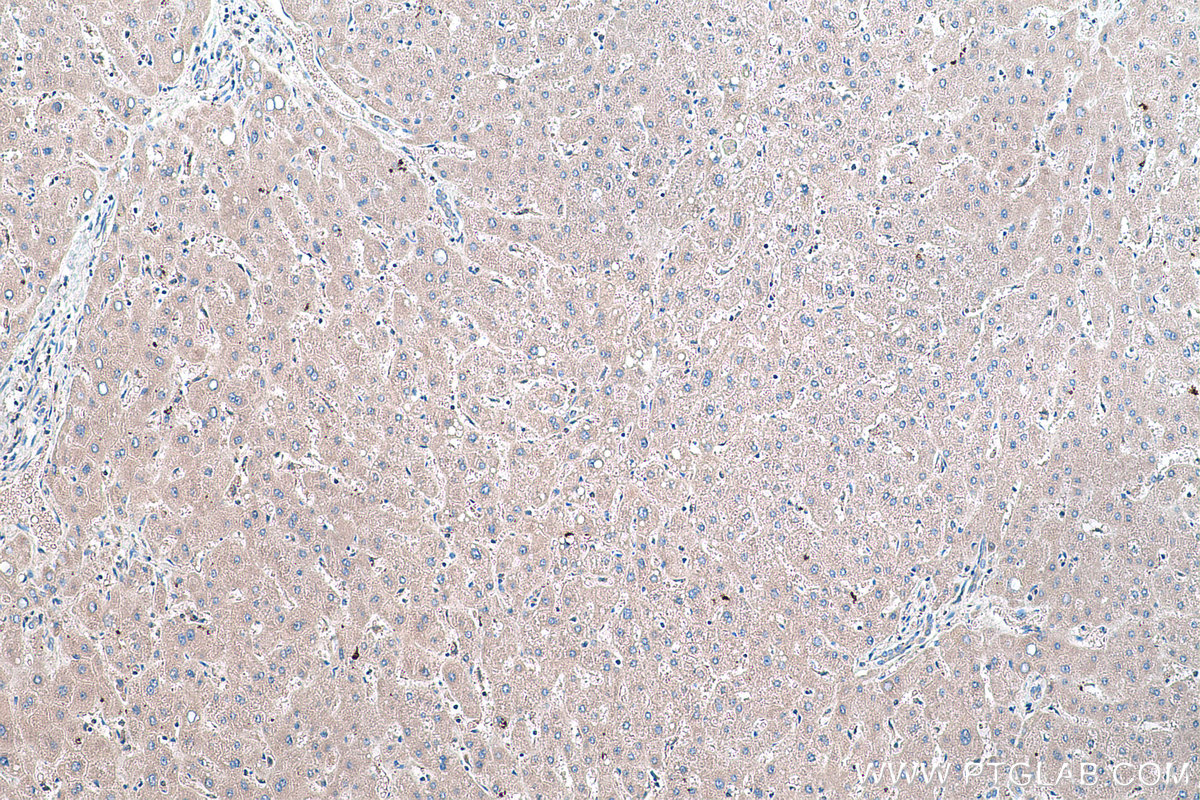 Immunohistochemical analysis of paraffin-embedded human liver tissue slide using KHC0426 (HPRT1 IHC Kit).
