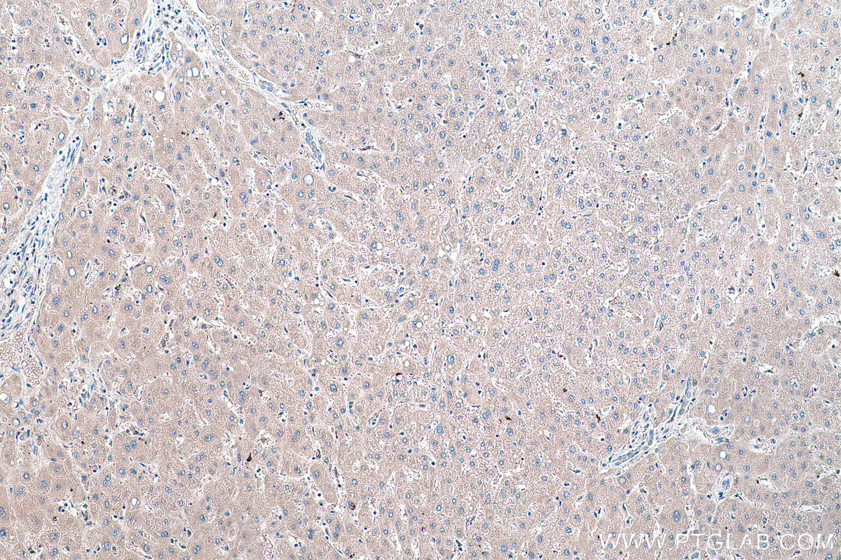 Immunohistochemical analysis of paraffin-embedded human liver tissue slide using KHC0426 (HPRT1 IHC Kit).