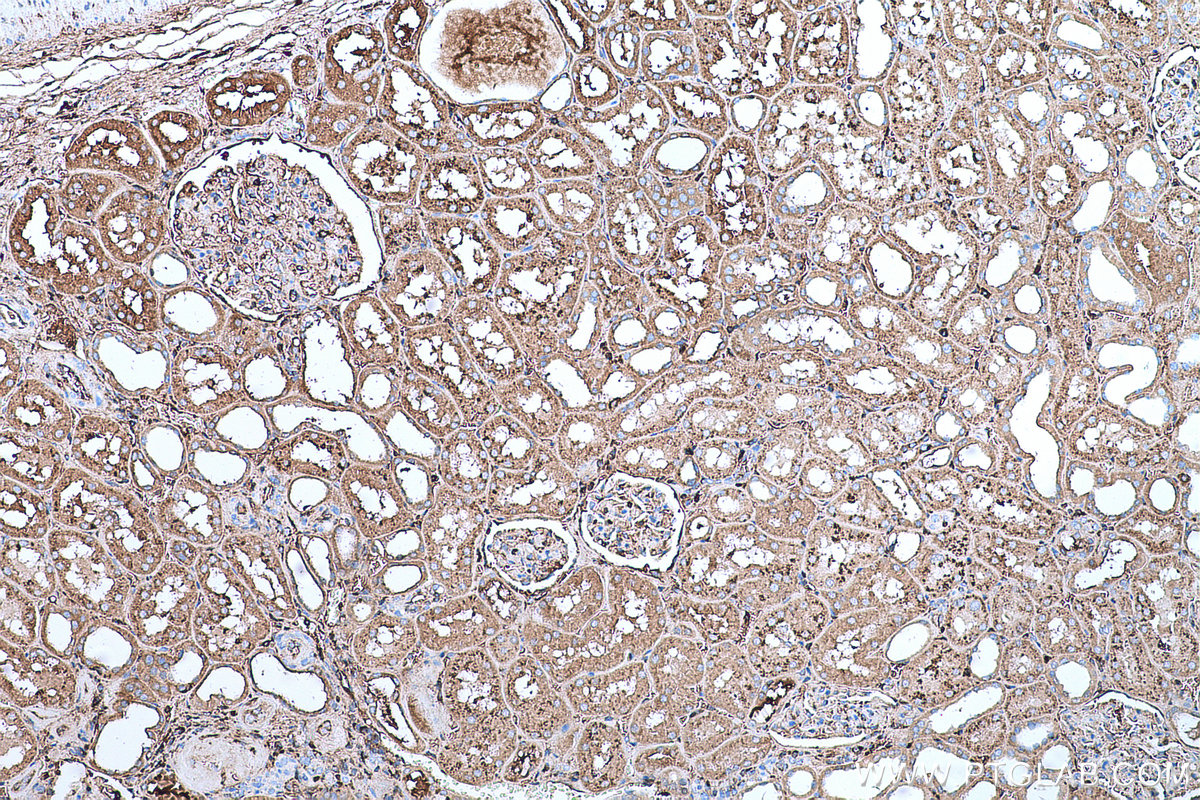 Immunohistochemical analysis of paraffin-embedded human kidney tissue slide using KHC0673 (HPX IHC Kit).