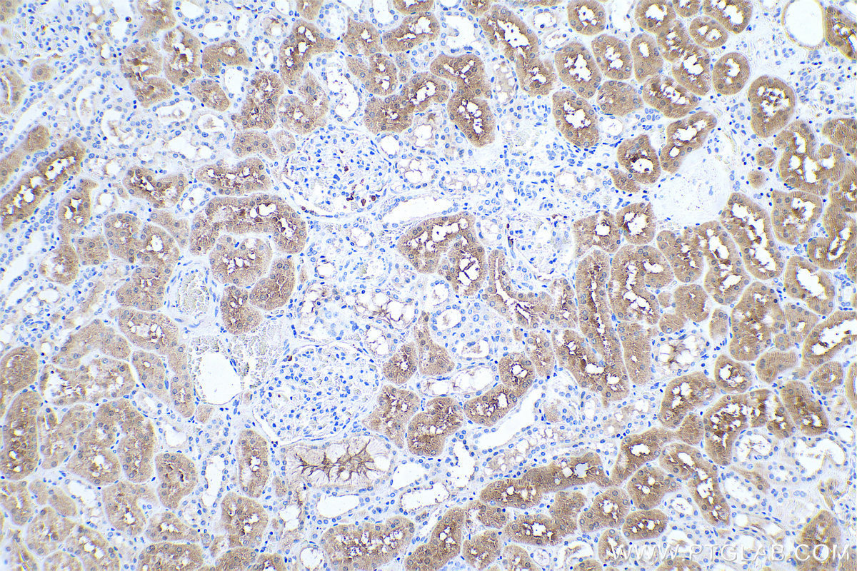 Immunohistochemical analysis of paraffin-embedded human kidney tissue slide using KHC0517 (HRSP12 IHC Kit).