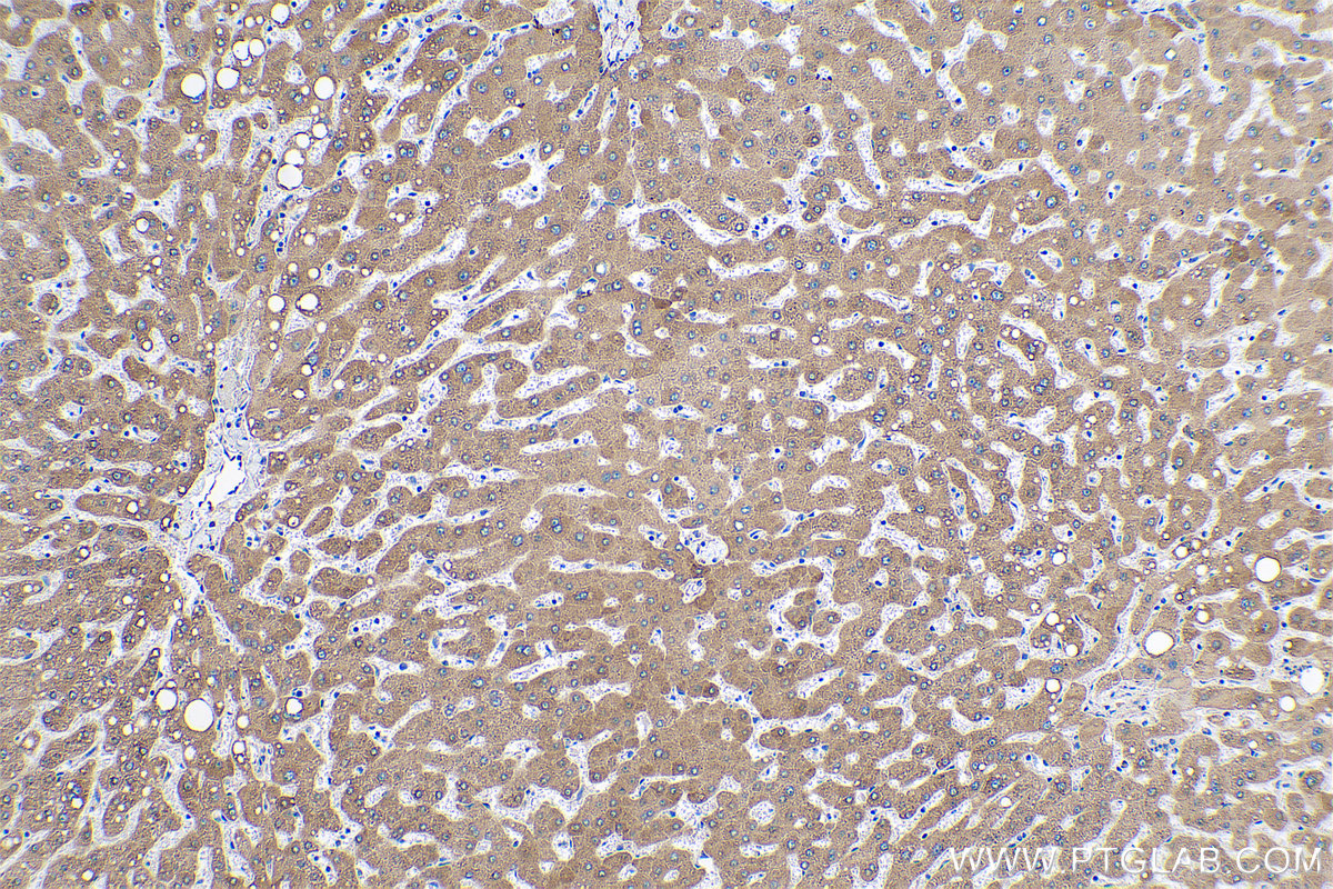 Immunohistochemical analysis of paraffin-embedded human liver tissue slide using KHC0625 (HSD17B2 IHC Kit).