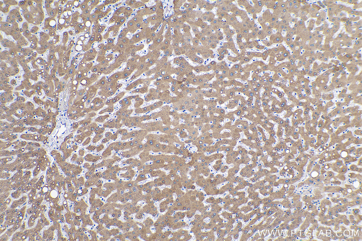 Immunohistochemical analysis of paraffin-embedded human liver tissue slide using KHC0625 (HSD17B2 IHC Kit).