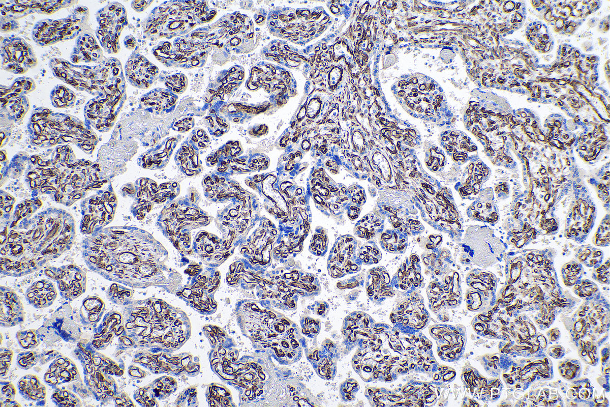 Immunohistochemical analysis of paraffin-embedded human placenta tissue slide using KHC0625 (HSD17B2 IHC Kit).