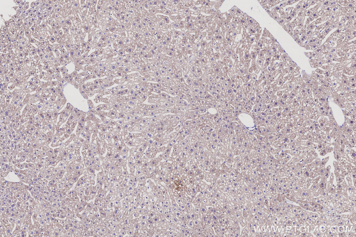 Immunohistochemical analysis of paraffin-embedded mouse liver tissue slide using KHC3136 (HSD17B6 IHC Kit).