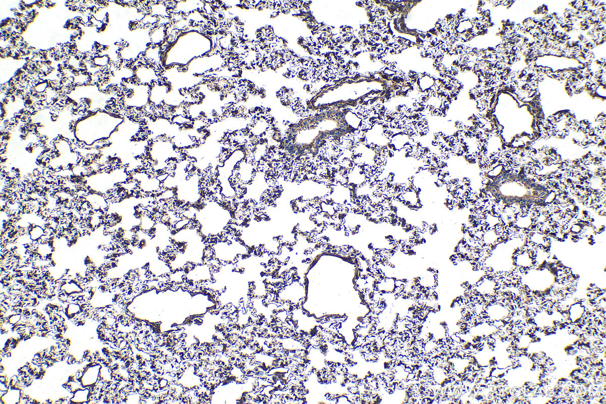 Immunohistochemical analysis of paraffin-embedded rat lung tissue slide using KHC1241 (HSP47 IHC Kit).