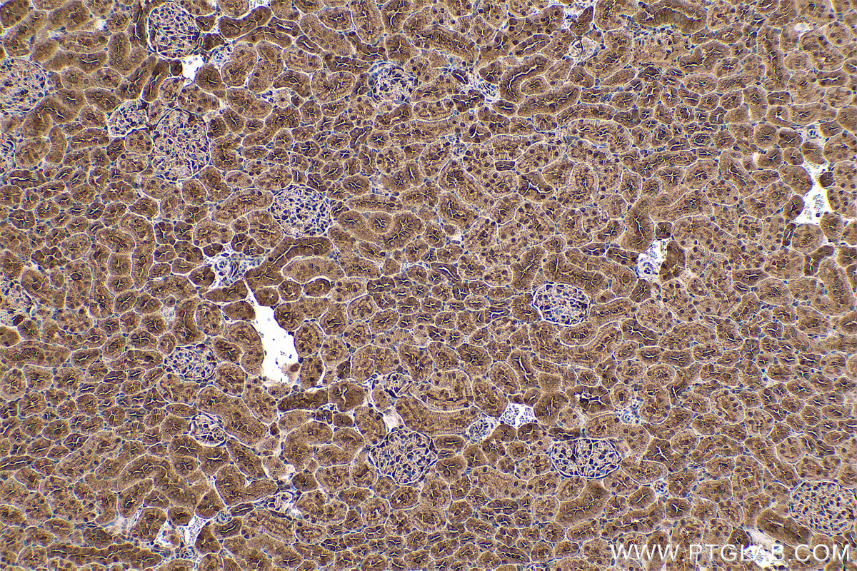 Immunohistochemical analysis of paraffin-embedded rat kidney tissue slide using KHC0564 (HSP90AB1 IHC Kit).