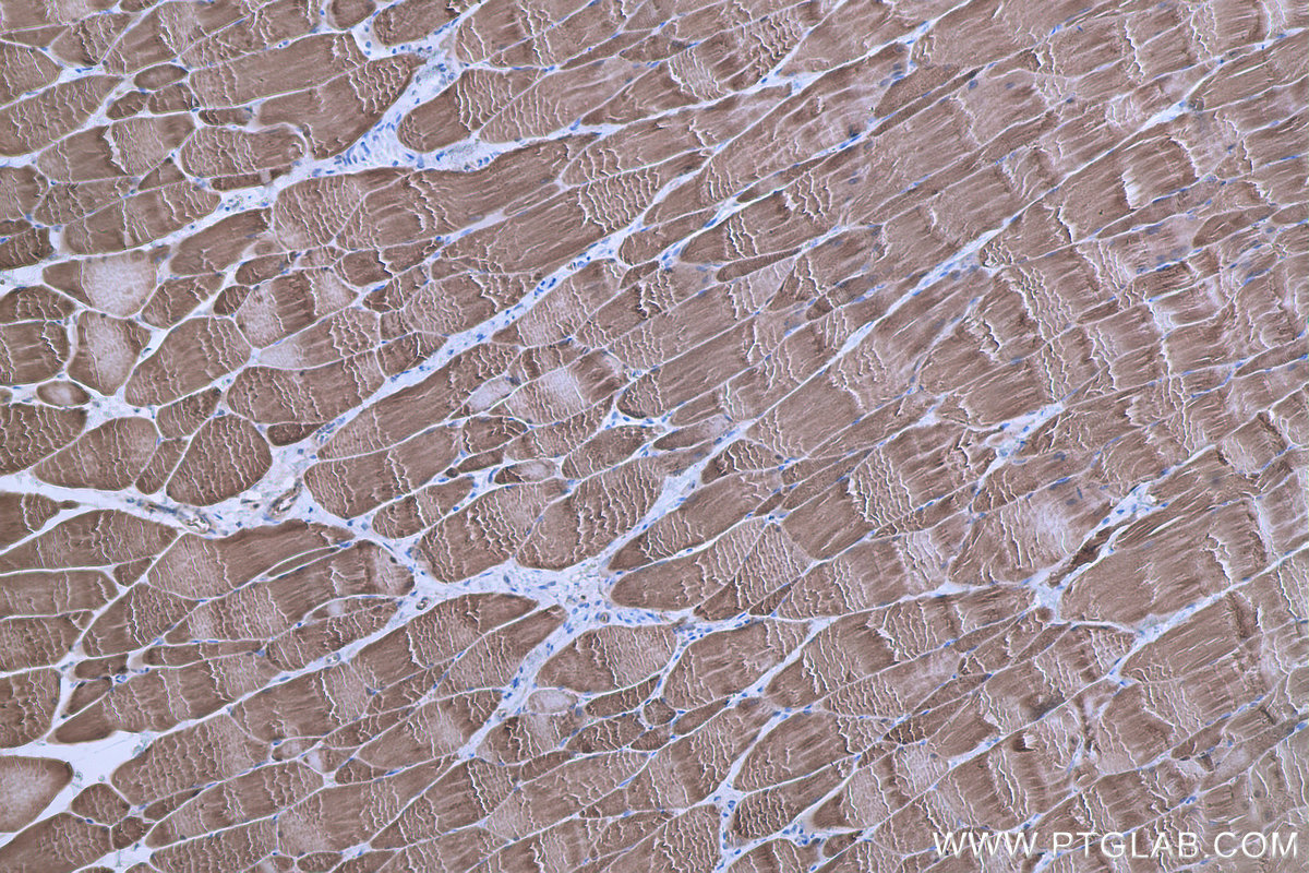 Immunohistochemical analysis of paraffin-embedded rat skeletal muscle tissue slide using KHC0668 (HSPB6 IHC Kit).