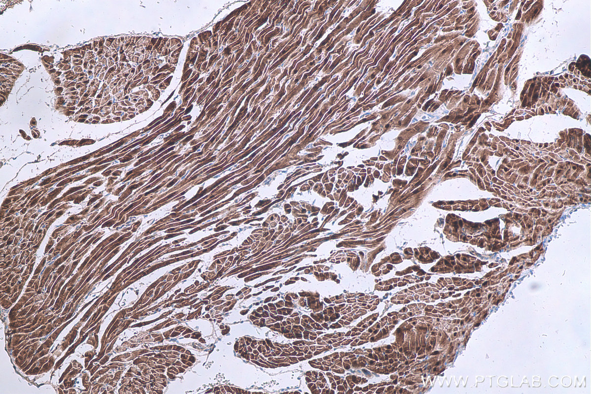 Immunohistochemical analysis of paraffin-embedded rat heart tissue slide using KHC0668 (HSPB6 IHC Kit).