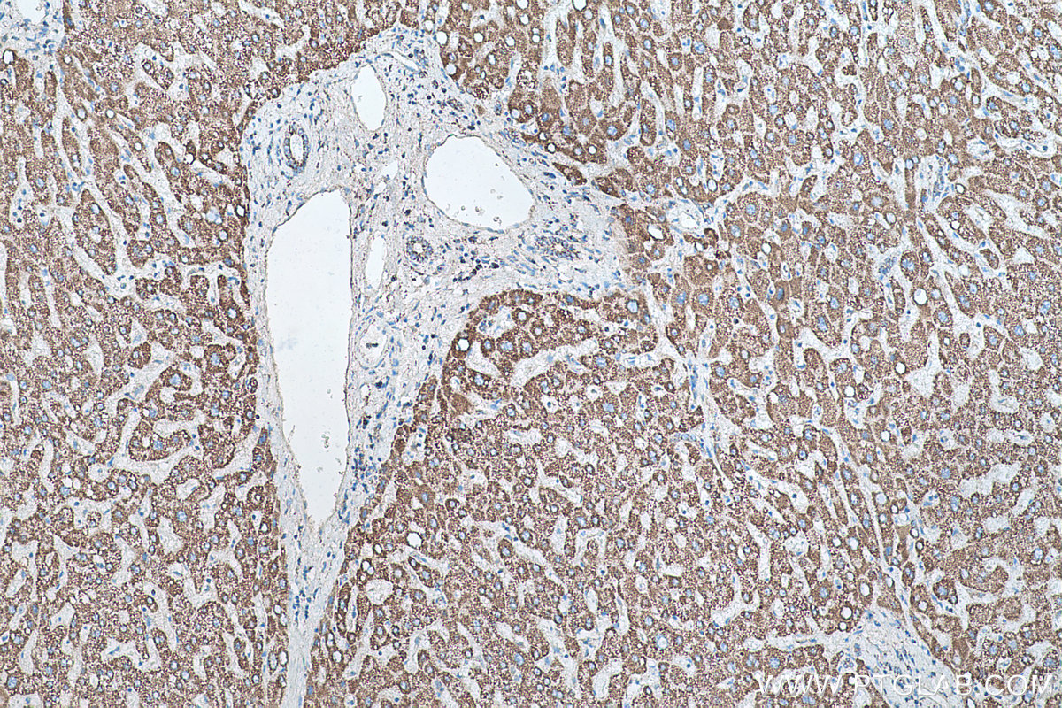 Immunohistochemical analysis of paraffin-embedded human liver tissue slide using KHC0505 (HSPD1 IHC Kit).