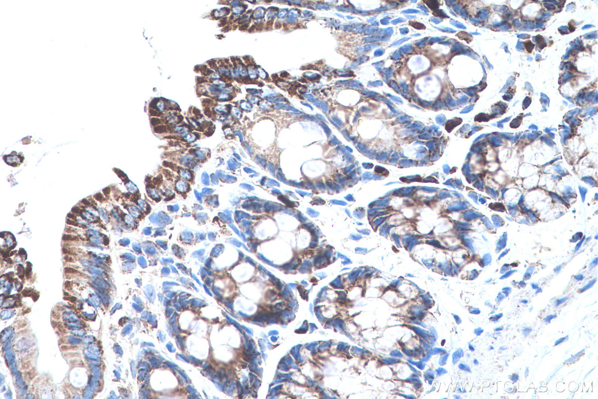 Immunohistochemical analysis of paraffin-embedded rat colon tissue slide using KHC0505 (HSPD1 IHC Kit).