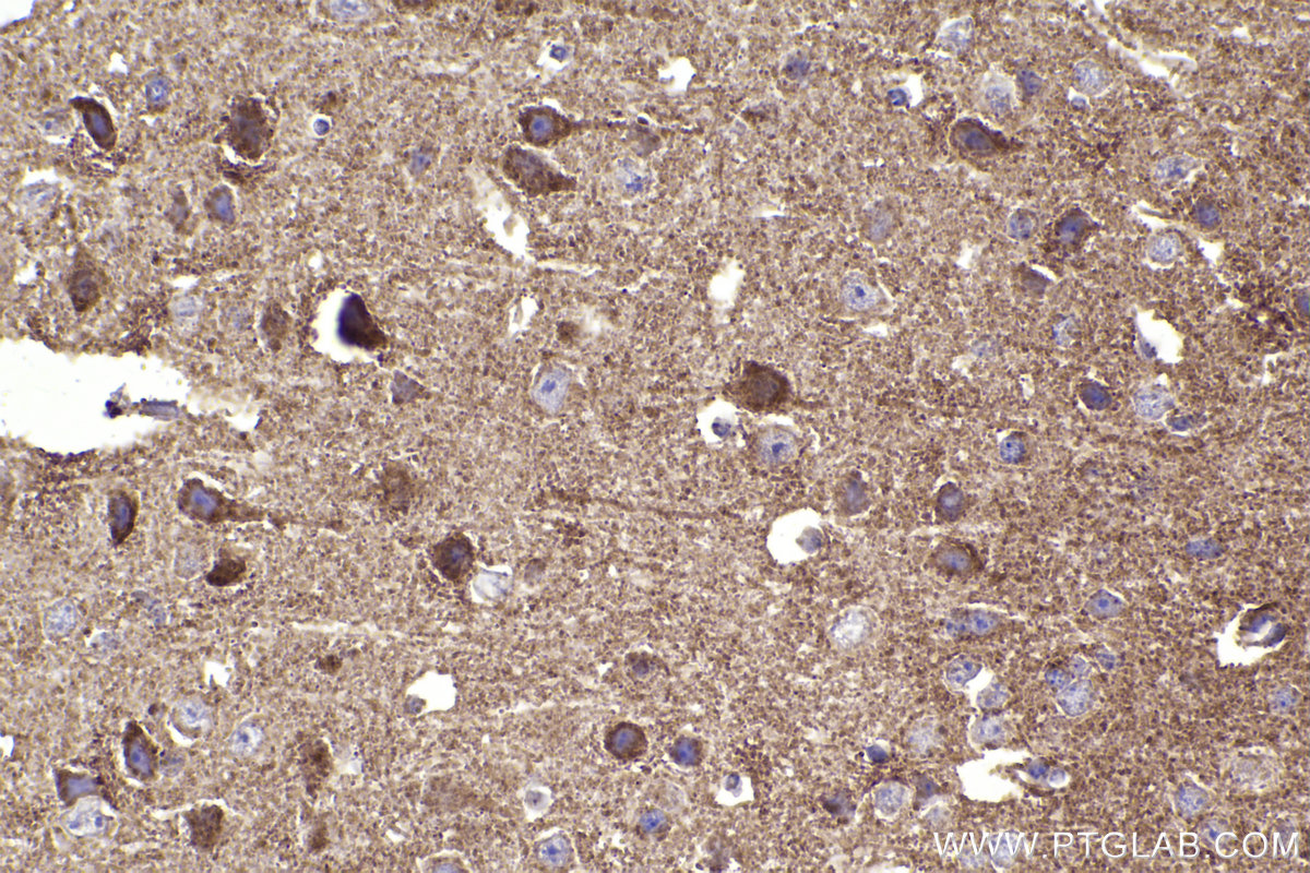 Immunohistochemical analysis of paraffin-embedded mouse brain tissue slide using KHC2340 (HSP10 IHC Kit).