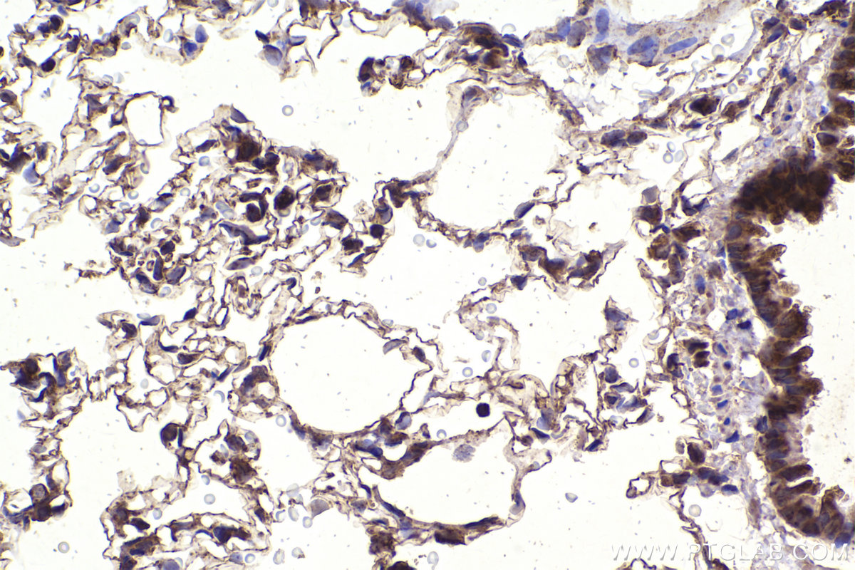 Immunohistochemical analysis of paraffin-embedded rat lung tissue slide using KHC2340 (HSP10 IHC Kit).