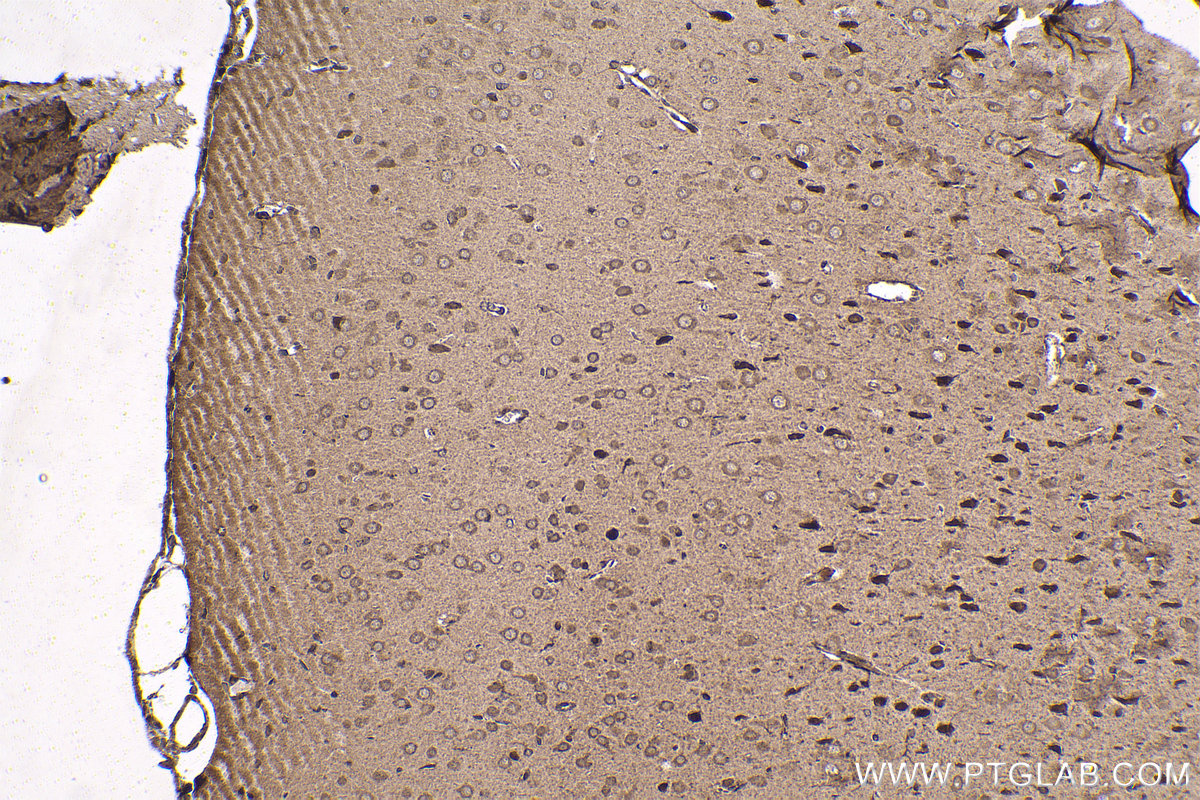 Immunohistochemical analysis of paraffin-embedded rat brain tissue slide using KHC1597 (HTT IHC Kit).