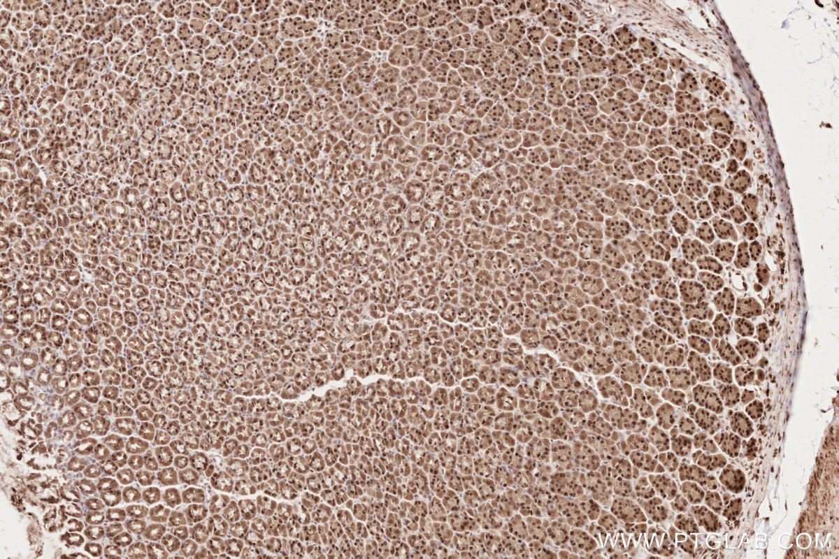 Immunohistochemical analysis of paraffin-embedded rat stomach tissue slide using KHC2627 (HUWE1 IHC Kit).