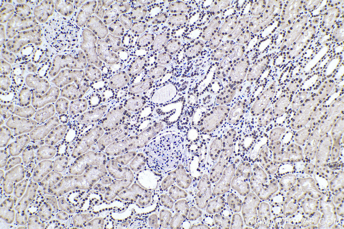 Immunohistochemical analysis of paraffin-embedded human kidney tissue slide using KHC0594 (Histone H1.0 IHC Kit).