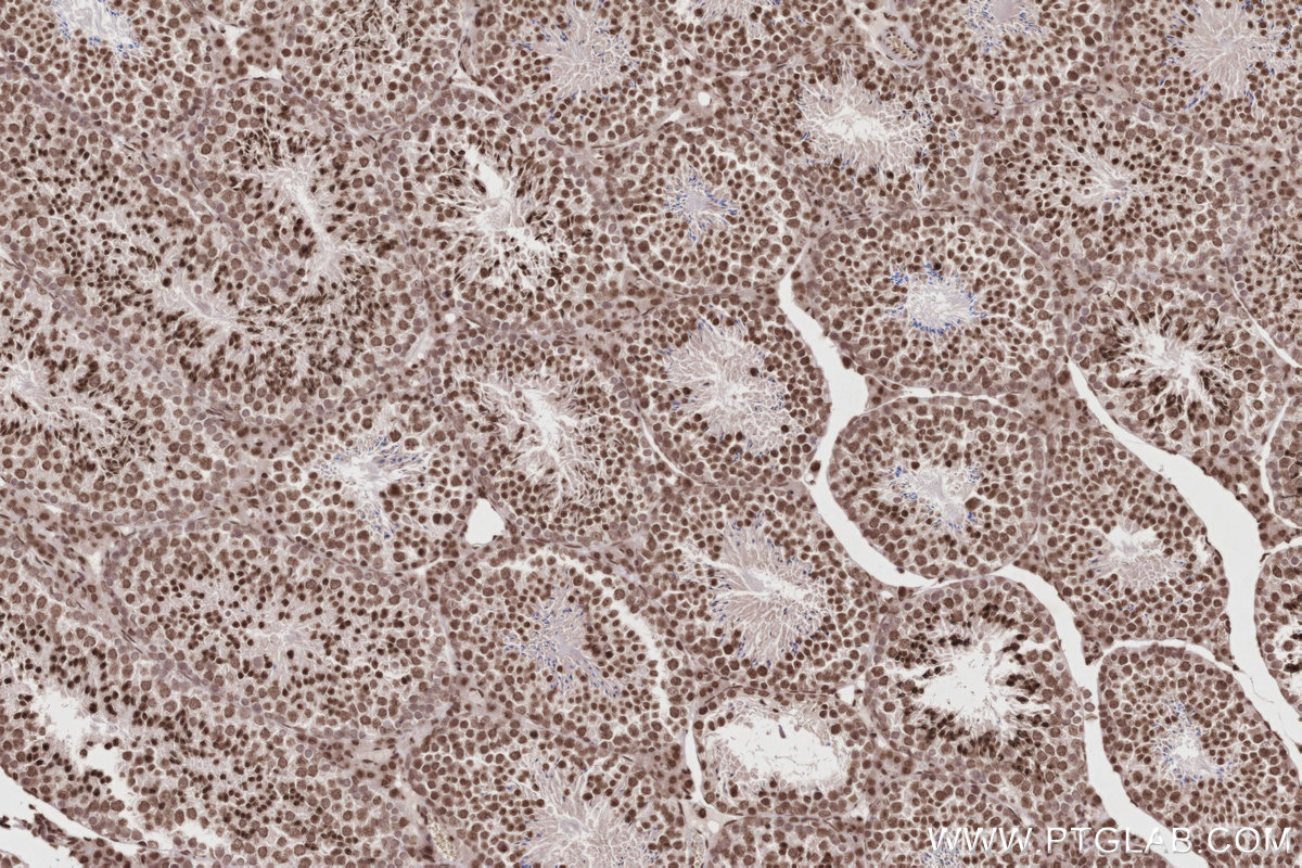 Immunohistochemical analysis of paraffin-embedded mouse testis tissue slide using KHC2823 (Histone H2A  IHC Kit).