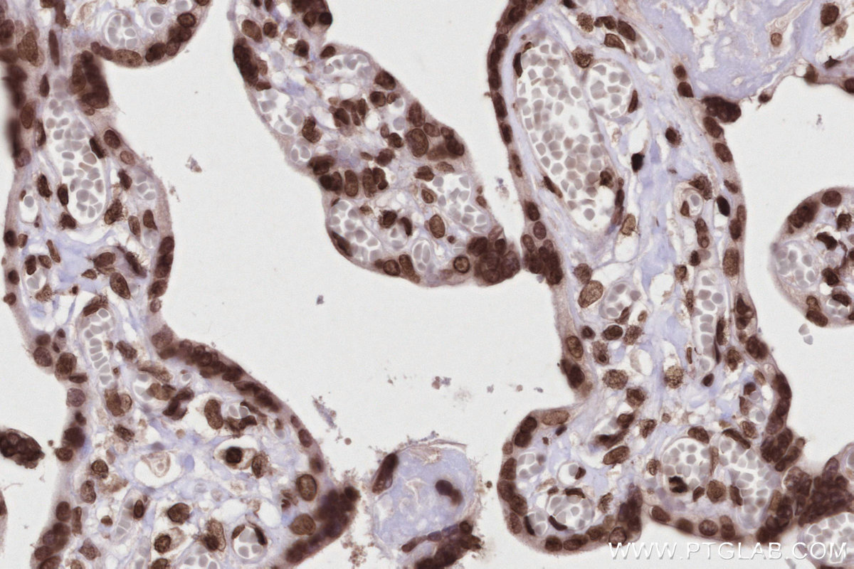 Immunohistochemical analysis of paraffin-embedded human placenta tissue slide using KHC2823 (Histone H2A  IHC Kit).