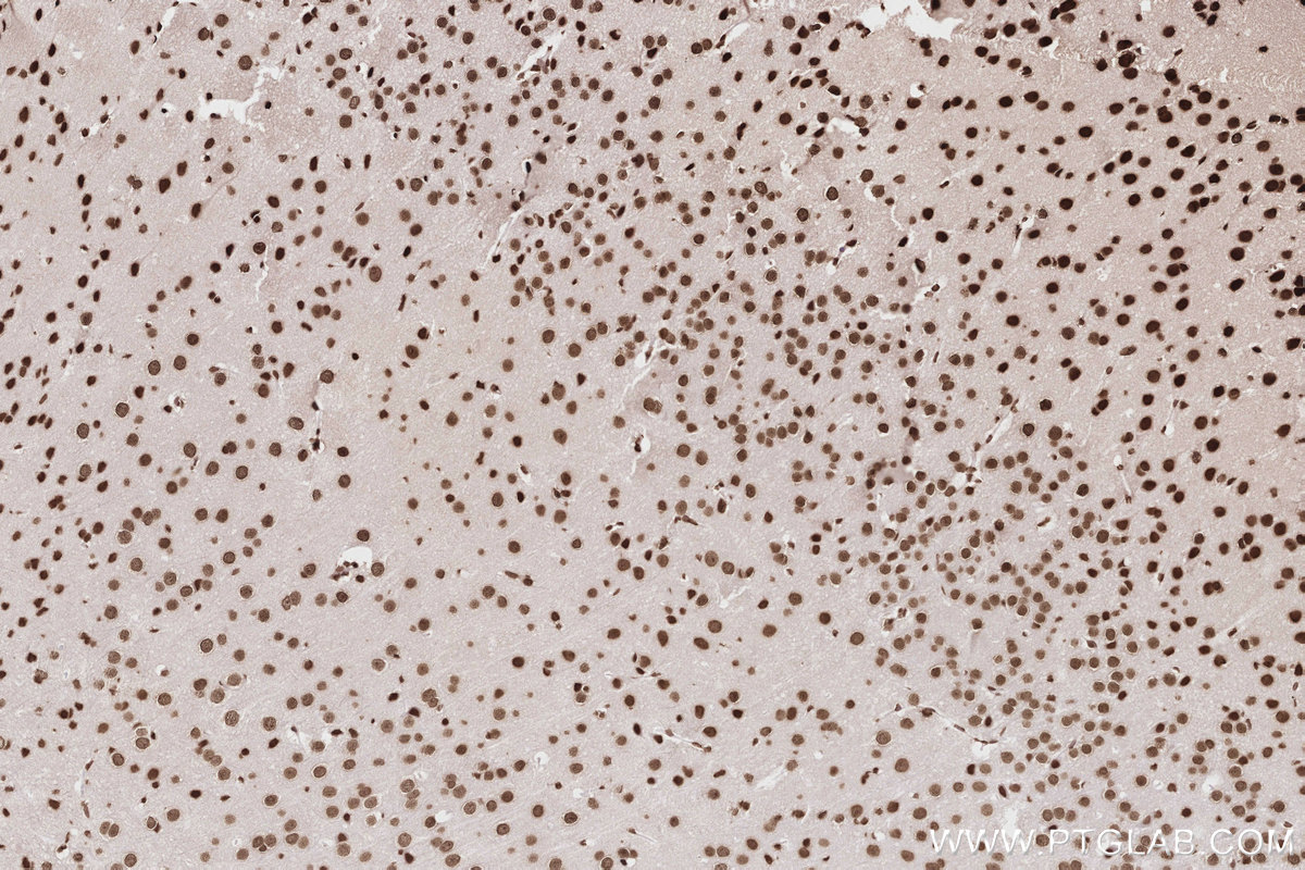 Immunohistochemical analysis of paraffin-embedded mouse brain tissue slide using KHC2823 (Histone H2A  IHC Kit).