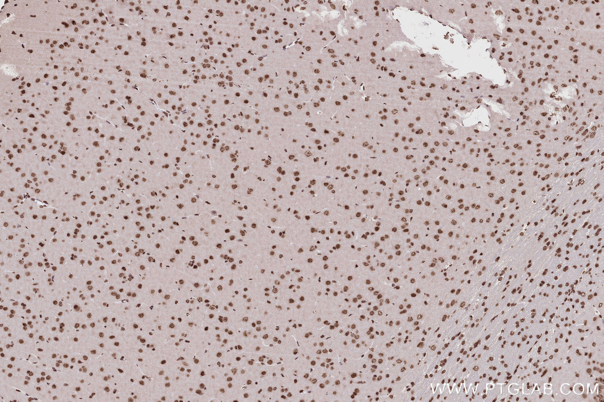 Immunohistochemical analysis of paraffin-embedded rat brain tissue slide using KHC2823 (Histone H2A  IHC Kit).