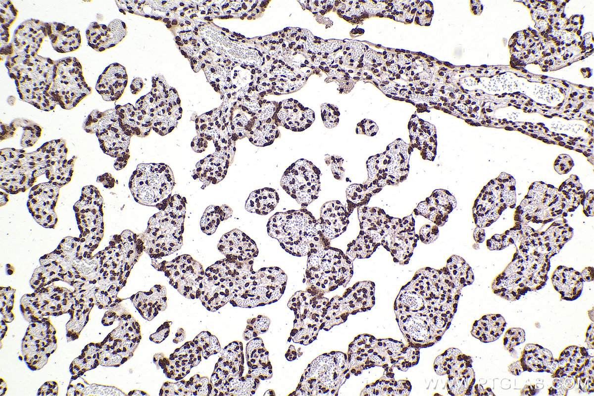 Immunohistochemical analysis of paraffin-embedded human placenta tissue slide using KHC2506 (Histone H3.4 IHC Kit).