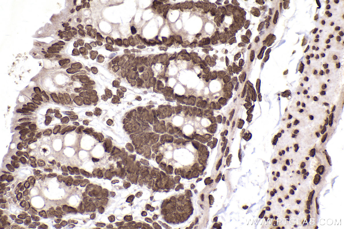 Immunohistochemical analysis of paraffin-embedded rat colon tissue slide using KHC2506 (Histone H3.4 IHC Kit).