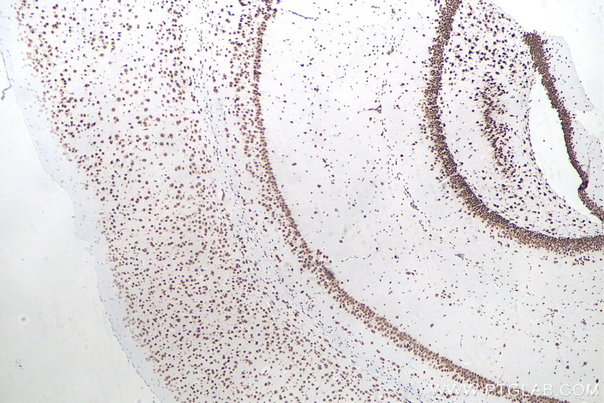 Immunohistochemical analysis of paraffin-embedded mouse brain tissue slide using KHC0049 (HuR IHC Kit).