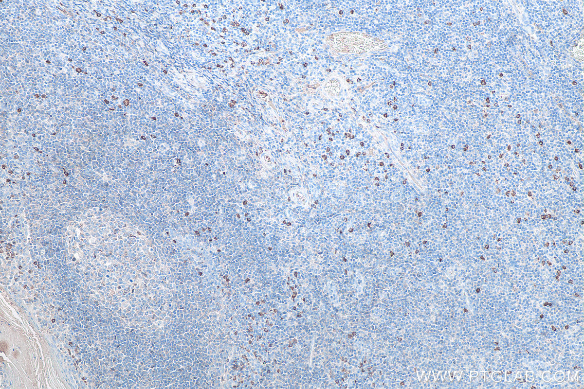 Immunohistochemical analysis of paraffin-embedded human tonsillitis tissue slide using KHC0070 (Human IgA IHC Kit).