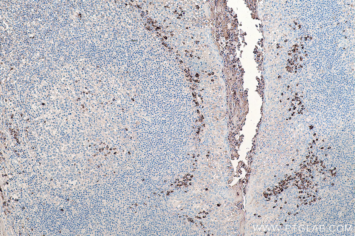 Immunohistochemical analysis of paraffin-embedded human tonsillitis tissue slide using KHC0072 (Human IgG Kappa chain IHC Kit).