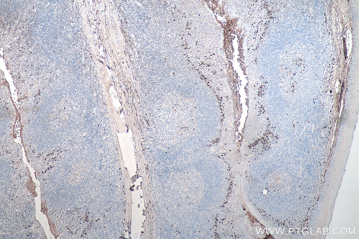 Immunohistochemical analysis of paraffin-embedded human tonsillitis tissue slide using KHC0072 (Human IgG Kappa chain IHC Kit).