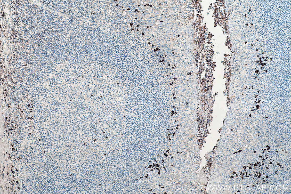 Immunohistochemical analysis of paraffin-embedded human tonsillitis tissue slide using KHC0074 (Human IgG4 IHC Kit).