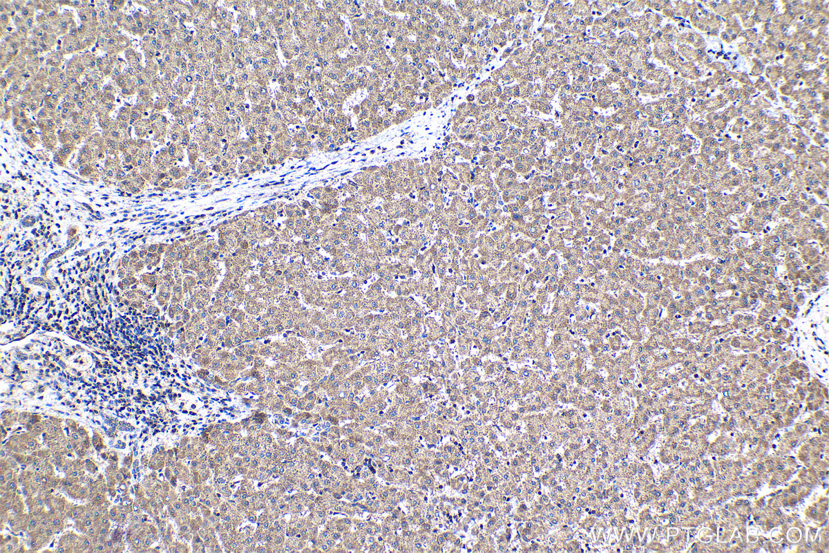 Immunohistochemical analysis of paraffin-embedded human liver tissue slide using KHC1238 (IARS2 IHC Kit).