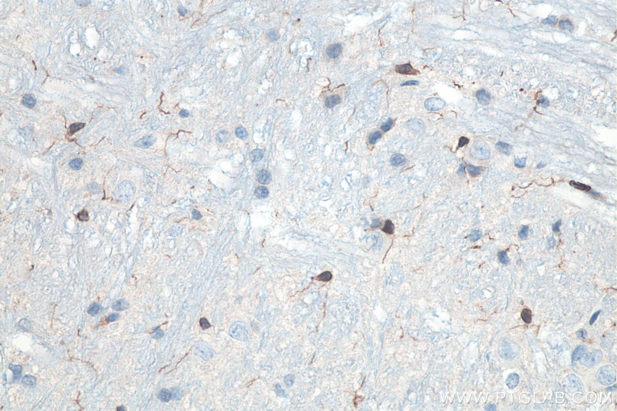Immunohistochemical analysis of paraffin-embedded rat cerebellum tissue slide using KHC0056 (IBA1 IHC Kit).