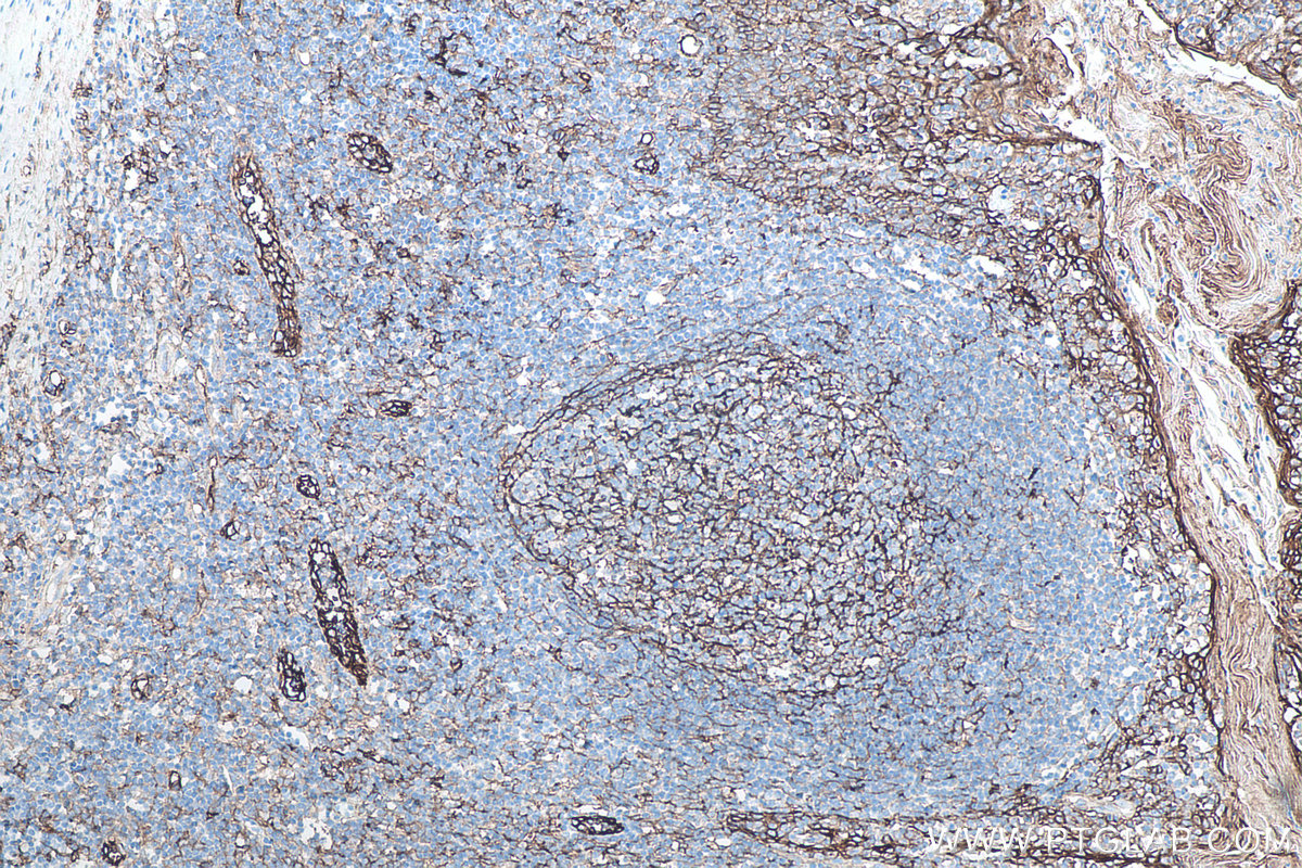 Immunohistochemical analysis of paraffin-embedded human tonsillitis tissue slide using KHC0080 (ICAM-1 IHC Kit).