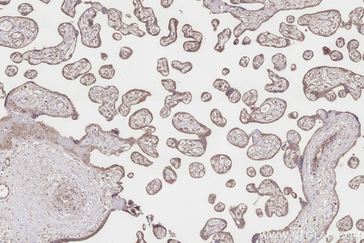 Immunohistochemical analysis of paraffin-embedded human placenta tissue slide using KHC3252 (ICT1 IHC Kit).