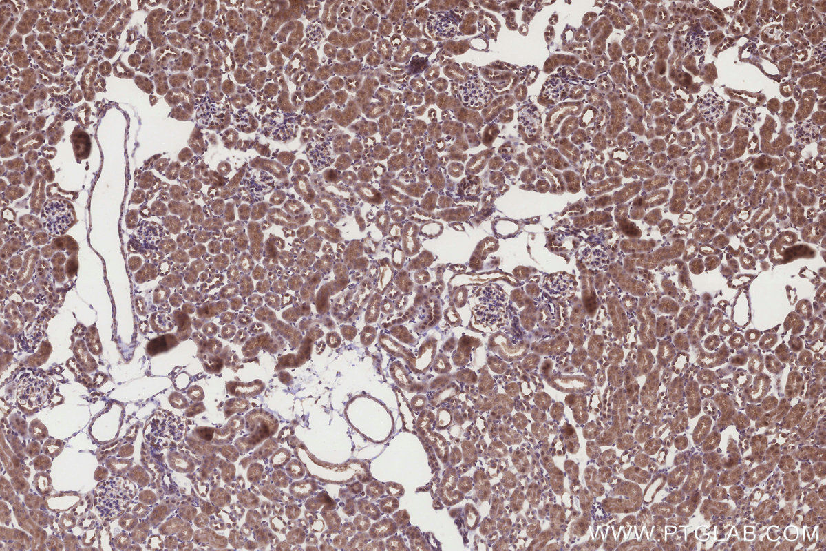Immunohistochemical analysis of paraffin-embedded mouse kidney tissue slide using KHC3252 (ICT1 IHC Kit).