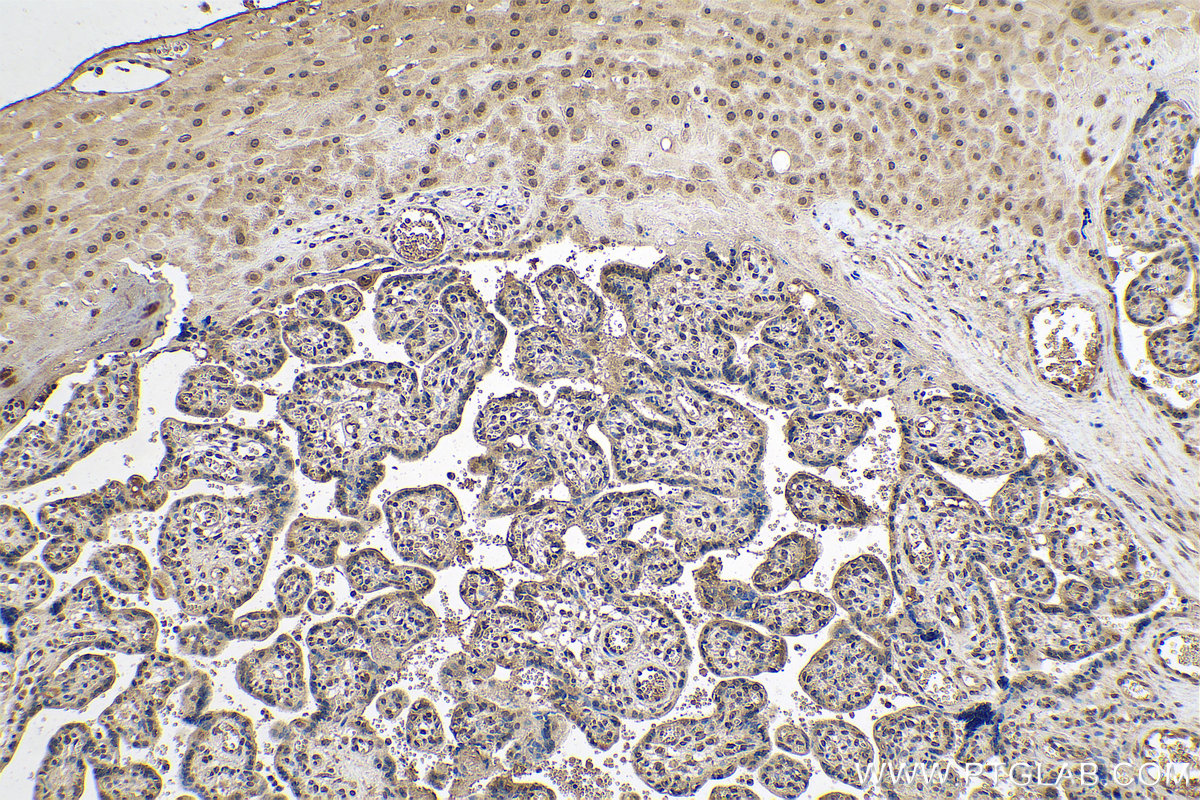 Immunohistochemical analysis of paraffin-embedded human placenta tissue slide using KHC0627 (ID1 IHC Kit).