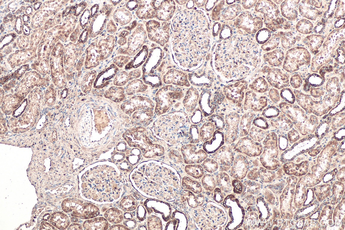 Immunohistochemical analysis of paraffin-embedded human kidney tissue slide using KHC0580 (IDH2 IHC Kit).