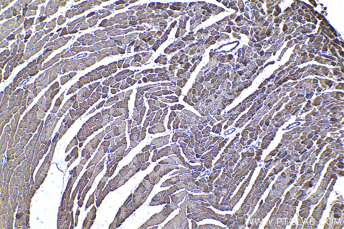 Immunohistochemical analysis of paraffin-embedded mouse heart tissue slide using KHC0580 (IDH2 IHC Kit).