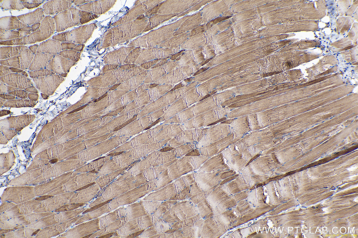 Immunohistochemical analysis of paraffin-embedded rat skeletal muscle tissue slide using KHC0580 (IDH2 IHC Kit).