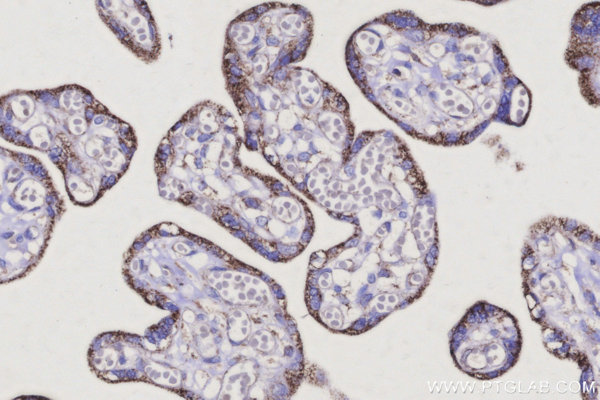 Immunohistochemical analysis of paraffin-embedded human placenta tissue slide using KHC3145 (IDH3B IHC Kit).