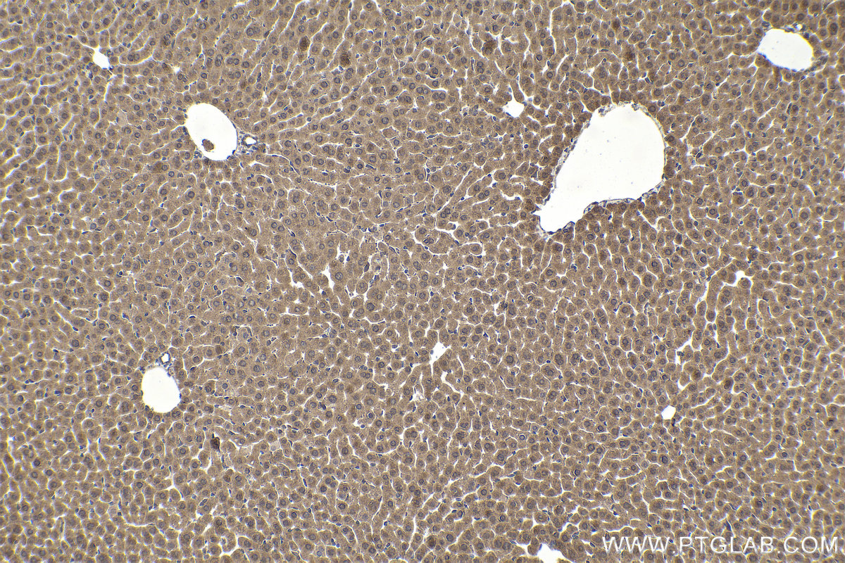 Immunohistochemical analysis of paraffin-embedded mouse liver tissue slide using KHC1904 (IER2 IHC Kit).