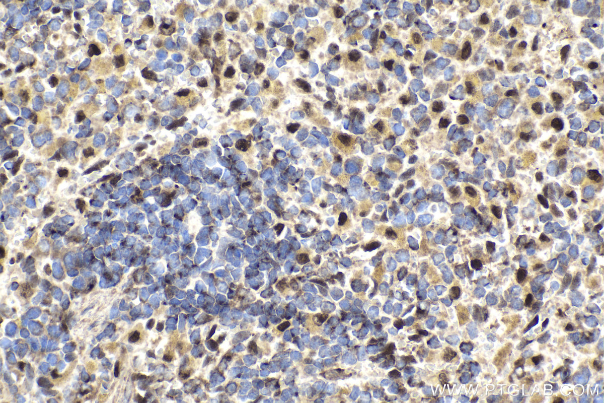 Immunohistochemical analysis of paraffin-embedded rat spleen tissue slide using KHC1764 (IFI16 IHC Kit).