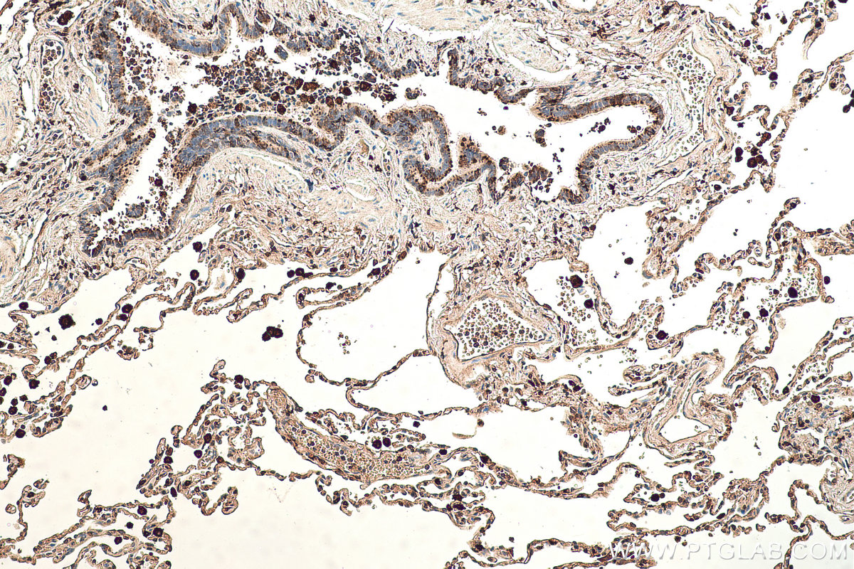 Immunohistochemical analysis of paraffin-embedded human lung tissue slide using KHC0429 (IFI30 IHC Kit).